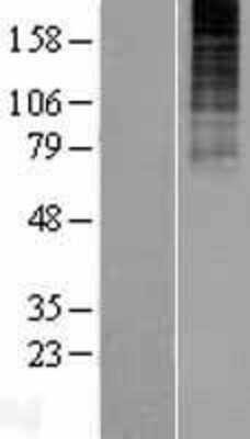 Western Blot: NK3R/TACR3/Neurokinin B Receptor Overexpression Lysate [NBP2-08339]