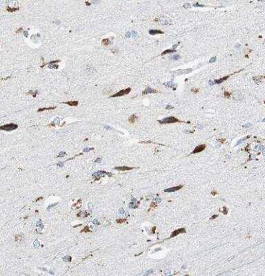 Immunohistochemistry-Paraffin: Neuroligin 1/NLGN1 Antibody [NBP1-87888]