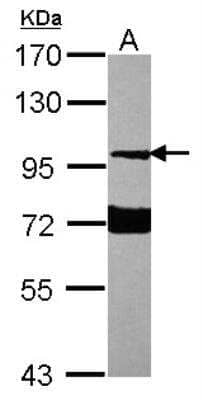 Western Blot: Neuroligin 1/NLGN1 Antibody [NBP2-19520]