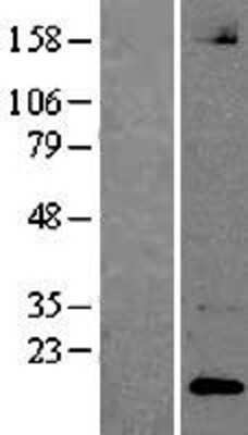 Western Blot: Neuroligin 1/NLGN1 Overexpression Lysate [NBP2-04347]