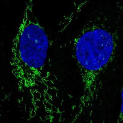 Immunocytochemistry/ Immunofluorescence: Neuroligin 2/NLGN2 Antibody [NBP2-56665]