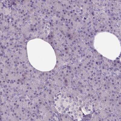 Immunohistochemistry-Paraffin: Neuroligin 2/NLGN2 Antibody [NBP2-49590]