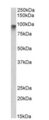 Western Blot: Neuroligin 2/NLGN2 Antibody [NBP1-00220]