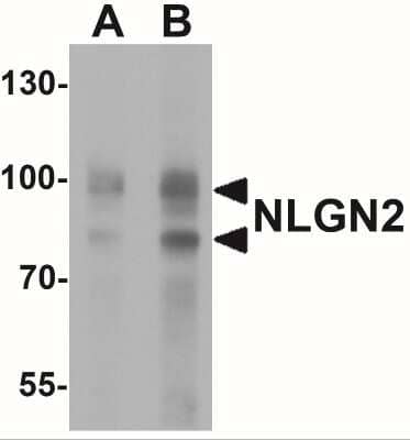 Western Blot: Neuroligin 2/NLGN2 AntibodyBSA Free [NBP2-41299]