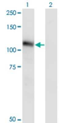 Western Blot: Neuroligin 3/NLGN3 Antibody (2A6) [H00054413-M02]