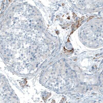 Immunohistochemistry-Paraffin: Neuroligin 3/NLGN3 Antibody [NBP1-90080]