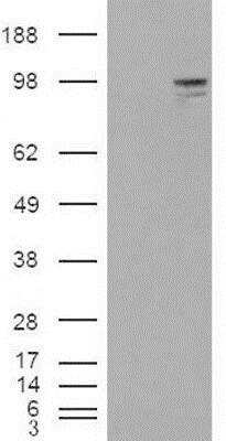 Western Blot: Neuroligin 3/NLGN3 Antibody [NB100-79866]