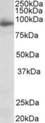 Western Blot: Neuroligin 4X/NLGN4X Antibody [NBP2-26141]