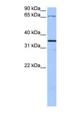 Western Blot: Neuroligin 4X/NLGN4X Antibody [NBP1-59255]