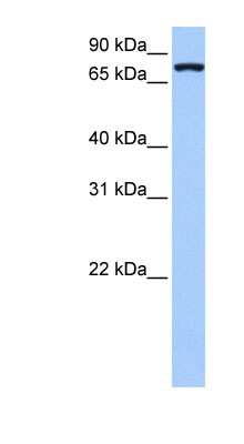 Western Blot: Neuroligin 4X/NLGN4X Antibody [NBP1-59256]