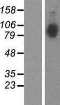 Western Blot: Neuroligin 4X/NLGN4X Overexpression Lysate [NBP2-04929]