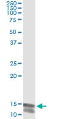 Immunoprecipitation: Neuroligin 4Y/NLGN4Y Antibody (2F7) [H00022829-M02]