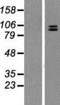 Western Blot: Neuroligin 4Y/NLGN4Y Overexpression Lysate [NBP2-10303]