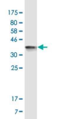 Western Blot: Neuroligin 4X/NLGN4X Antibody (5A11) [H00057502-M01A-200ul]