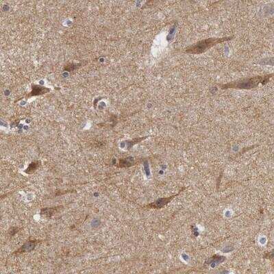 Immunohistochemistry: Neuroligin 4X/NLGN4X Antibody [NBP1-89684]