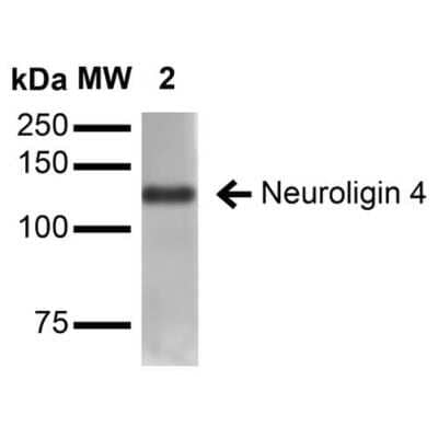 Western Blot: Neuroligin 4X/NLGN4X Antibody (S98-7) [NBP2-42198]