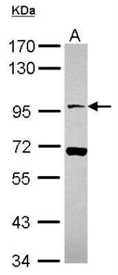 Western Blot: Neuroligin 4X/NLGN4X Antibody [NBP2-19521]