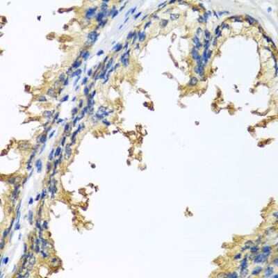 Immunohistochemistry-Paraffin: Neuroligin 4Y/NLGN4Y Antibody - BSA Free [NBP2-93145]