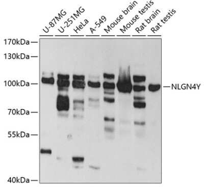 Western Blot: Neuroligin 4Y/NLGN4Y AntibodyBSA Free [NBP2-93145]