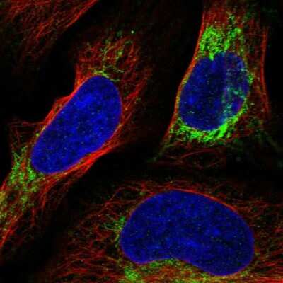 Immunocytochemistry/ Immunofluorescence: Neurolysin Antibody [NBP1-89198]