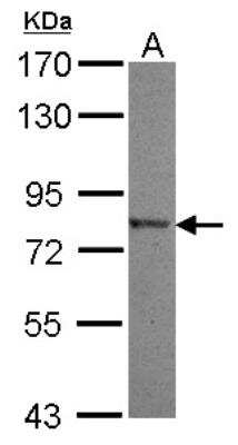 Western Blot: Neurolysin Antibody [NBP2-19547]