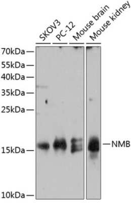 Western Blot: Neuromedin B AntibodyAzide and BSA Free [NBP2-93843]