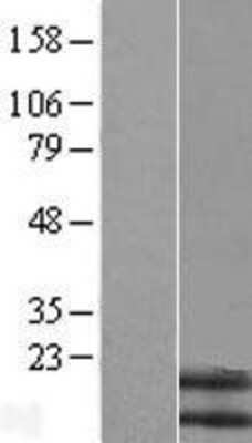 Western Blot: Neuromedin B Overexpression Lysate [NBL1-13679]