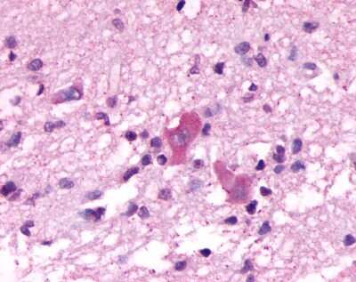 Immunohistochemistry-Paraffin: Neuromedin BR/NMBR Antibody - BSA Free [NLS825]