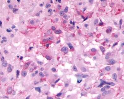 Immunohistochemistry-Paraffin: Neuromedin BR/NMBR Antibody - BSA Free [NLS825]