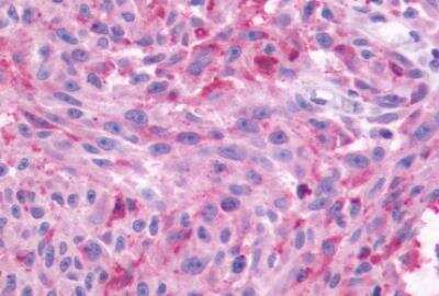 Immunohistochemistry-Paraffin: Neuromedin BR/NMBR Antibody - BSA Free [NLS825]