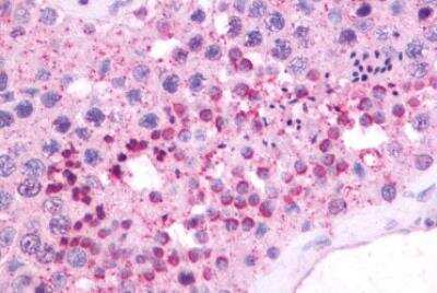 Immunohistochemistry-Paraffin: Neuromedin BR/NMBR Antibody - BSA Free [NLS825]