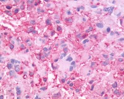 Immunohistochemistry-Paraffin: Neuromedin BR/NMBR Antibody - BSA Free [NLS828]