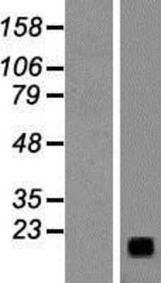 Western Blot: Gastrin-releasing Peptide/Bombesin/Neuromedin C Overexpression Lysate [NBP2-10801]