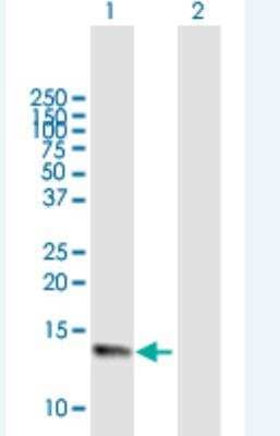 Western Blot: Neuromedin S Antibody [H00129521-B01P-50ug]