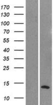 Western Blot: Neuromedin S Overexpression Lysate [NBP2-11002]