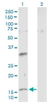 Western Blot: Neuromedin-U Antibody [H00010874-B02P]