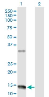 Western Blot: Neuromedin-U Antibody [H00010874-D01P]