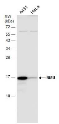 Western Blot: Neuromedin-U Antibody [NBP3-13020]