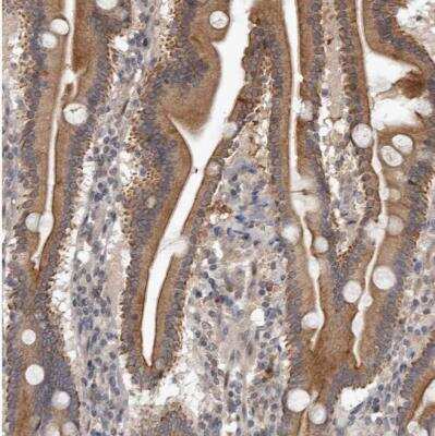 Immunohistochemistry-Paraffin: Neuromedin UR1/NMUR1 Antibody [NBP1-83433]