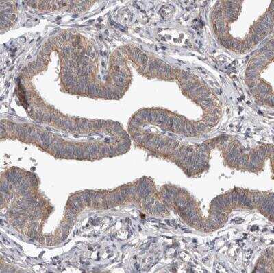 Immunohistochemistry-Paraffin: Neuromedin UR1/NMUR1 Antibody [NBP1-83433]