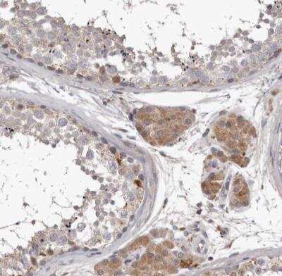 Immunohistochemistry-Paraffin: Neuromedin UR1/NMUR1 Antibody [NBP1-83433]