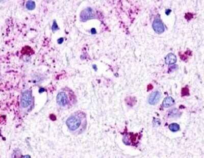 Immunohistochemistry-Paraffin: Neuromedin UR1/NMUR1 Antibody - BSA Free [NLS396]
