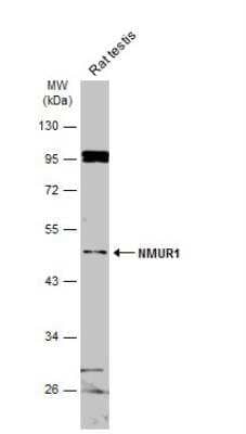 Western Blot: Neuromedin UR1/NMUR1 Antibody [NBP2-19556]