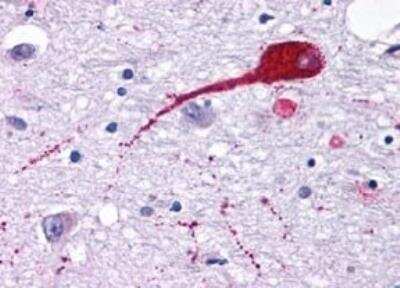 Immunohistochemistry-Paraffin: Neuromedin UR2/NMUR2 Antibody - BSA Free [NLS422]