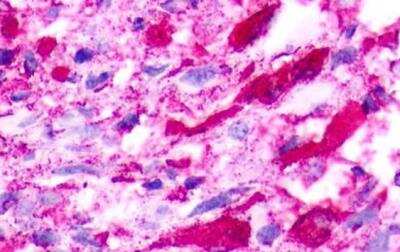 Immunohistochemistry-Paraffin: Neuromedin UR1/NMUR1 Antibody - BSA Free [NLS396]