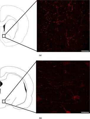 Immunohistochemistry: Neuromedin UR2/NMUR2 Antibody - BSA Free [NBP1-02351]