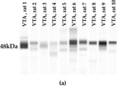 Western Blot: Neuromedin UR2/NMUR2 AntibodyBSA Free [NBP1-02351]