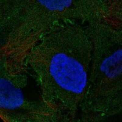 Immunocytochemistry/ Immunofluorescence: Neuromedin UR2/NMUR2 Antibody [NBP3-17281]