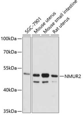 Western Blot: Neuromedin UR2/NMUR2 AntibodyAzide and BSA Free [NBP2-93230]