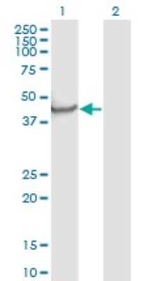 Western Blot: Neuronal Pentraxin 1 Antibody (7E6) [H00004884-M06]